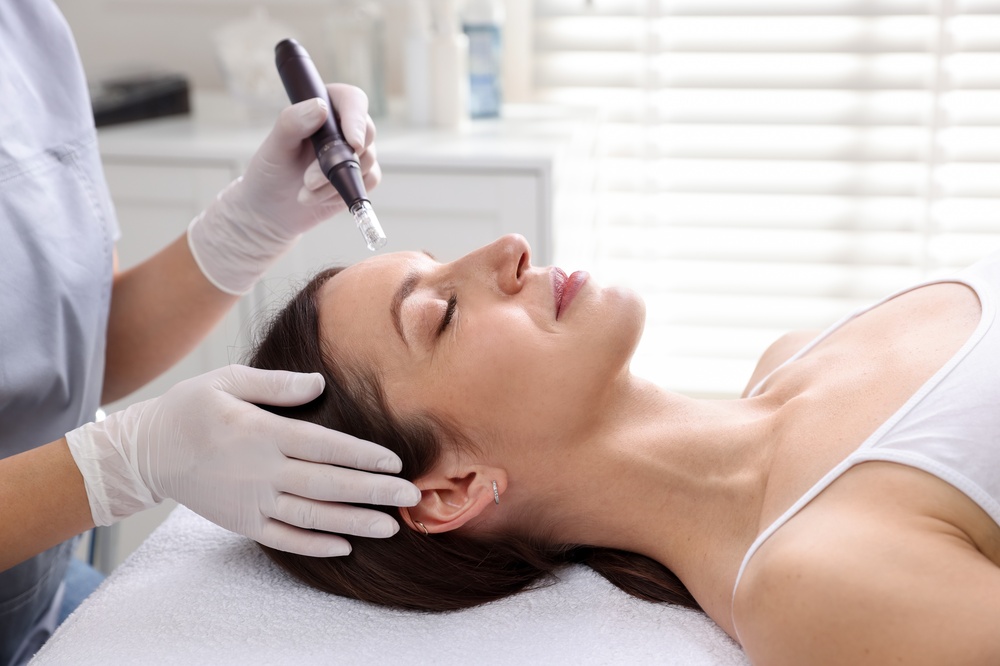 Woman undergoing microneedling procedure in beauty salon, closeup